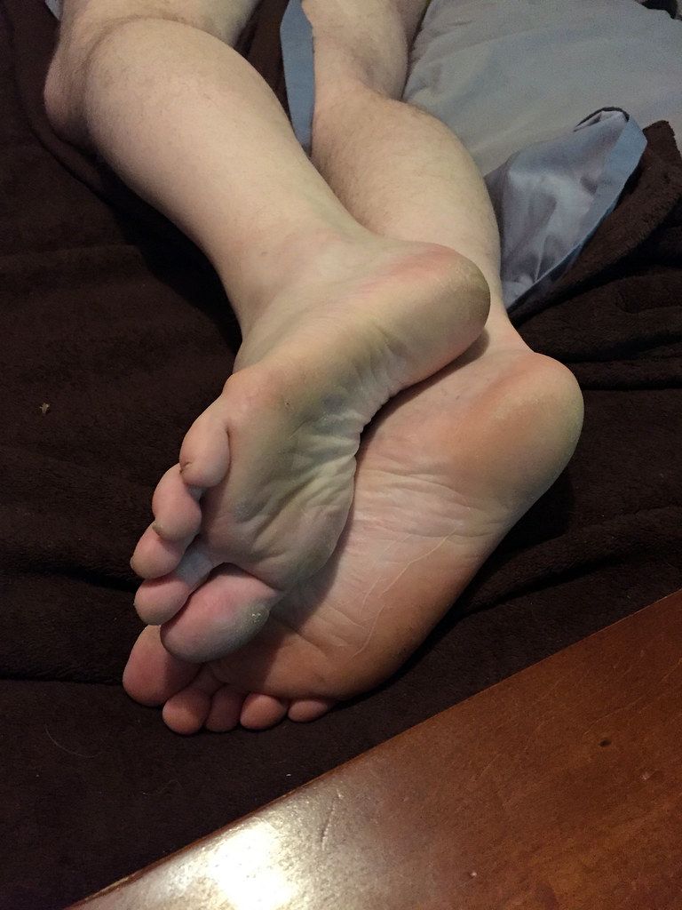 Limp sleepy feet photos